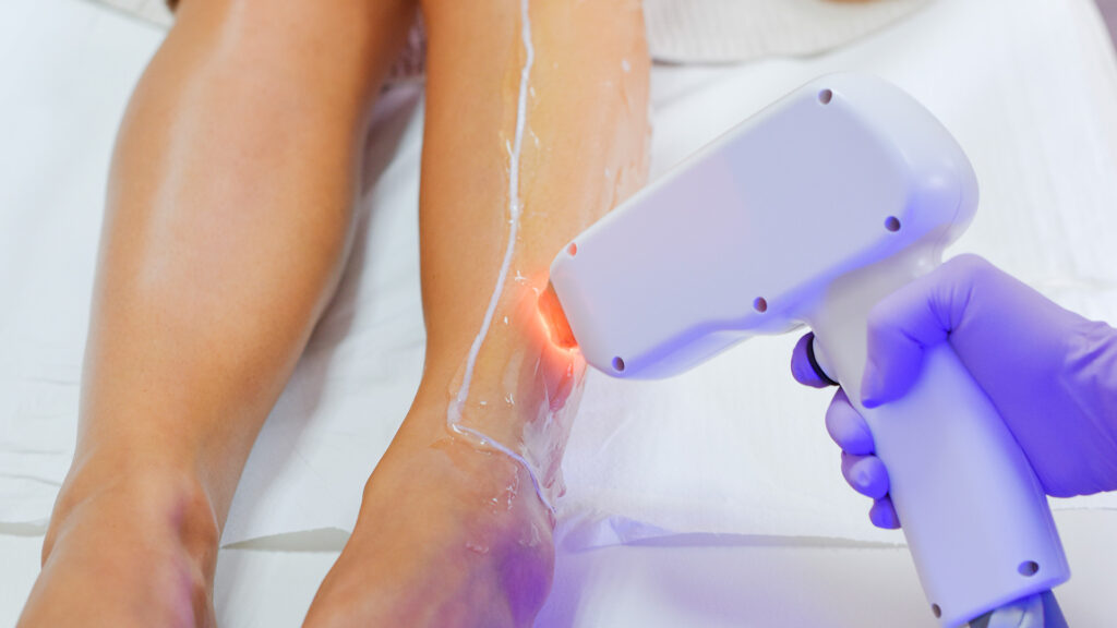 buz baslık ısınma problemi